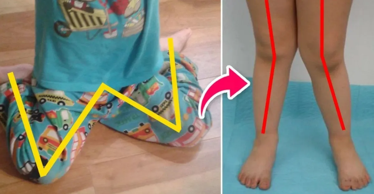 Миф или правда: вредна ли для ребенка W-поза?