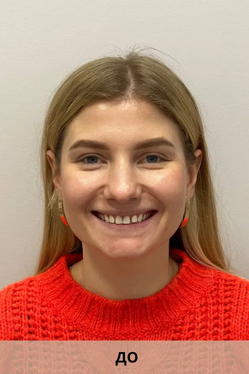 Идеальная улыбка: где поставить брекеты в Минске для взрослых и детей