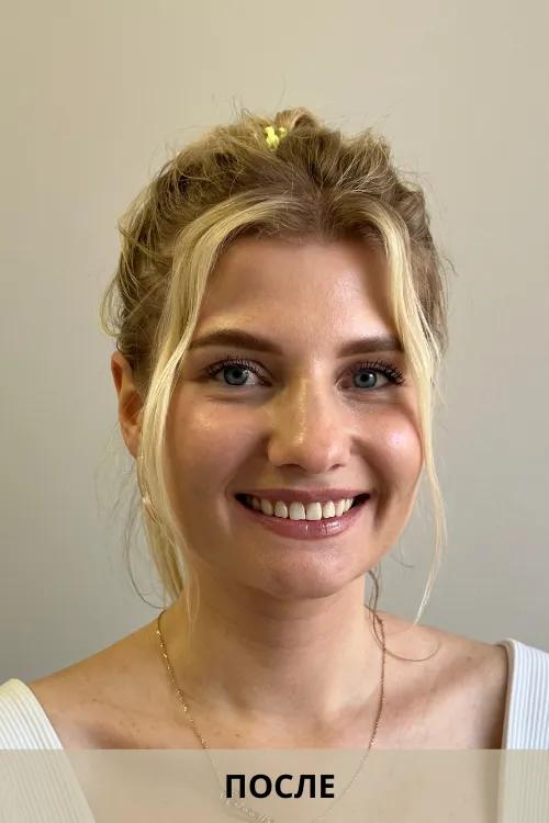 Идеальная улыбка: где поставить брекеты в Минске для взрослых и детей