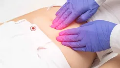 Миома матки: врач-гинеколог рассказала о причинах, диагностике и лечении