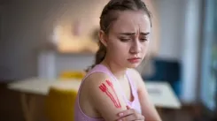 Селфхарм: почему подросток причиняет себе вред и как ему помочь